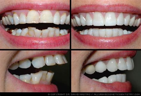 The Ultimate Guide to Your Cosmetic Dentistry Salary: Earnings, Outlook, and Launching Your Career