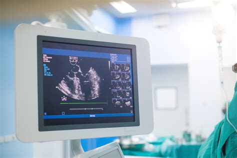 Echocardiogram Technician Salary: A Comprehensive Guide for 2024