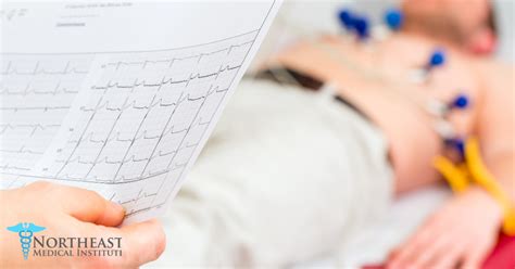 Decoding Your Earning Potential: A Deep Dive into the Electrocardiogram Technician Salary