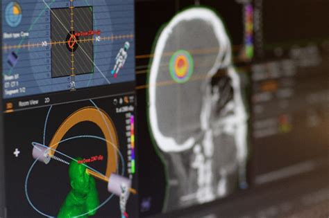 Medical Dosimetrist Salary: A 2024 Guide to Your Earning Potential