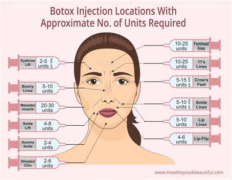 What Does a Botox Injector Do?