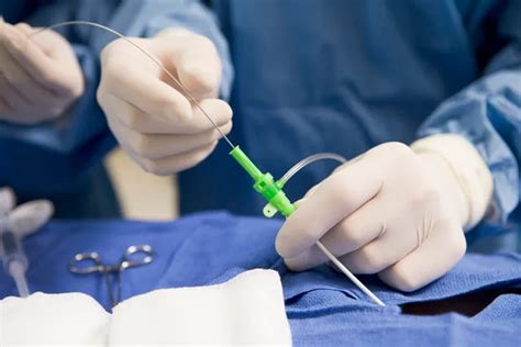 What Does a Cath Lab Tech Do?
