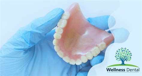 What Does a Denture Technician Do?