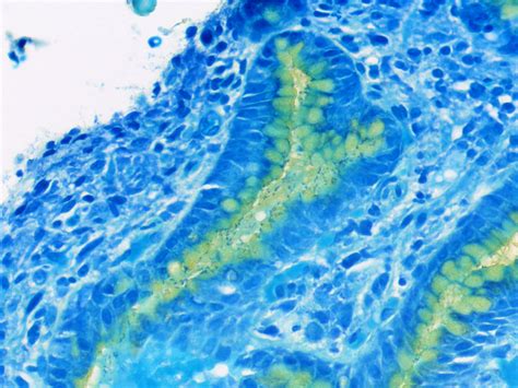 What Does a Histology Tech Do?