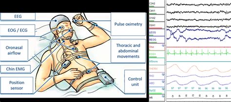 What Does a Polysomnography Tech Do?