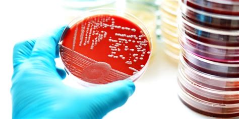 What Does an Infectious Disease Specialist Do?